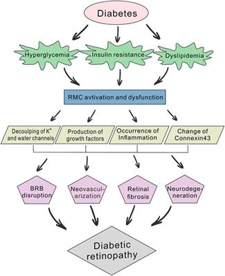 The role of retinal Müller cells in diabetic retinopathy and related therapeutic advances